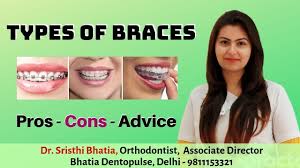 What causes gap in front teeth? Gap In Front Teeth Diastema Closure How To Fix Teeth Gap Without Braces Gapalign Dr Srishti Youtube