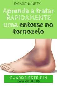 Calo Na Sola Do Pé O Que Fazer Como Tratar Rapidamente Uma Luxacao Ou Entorse De Tornozelo Entorse Remedios Caseiros Para Inchaco Dor Muscular