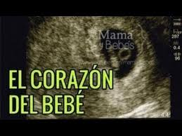 El Doctor Dijo Que El Corazon De Mi Bebe No Latia Cuando Late Y Como Verlo O Escucharlo Youtube