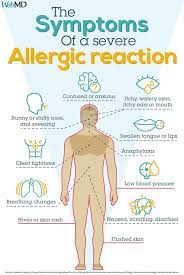 Signs Of Severe Allergic Reaction Symptoms Of Allergic Reaction Allergic Rhinitis Allergic Reaction