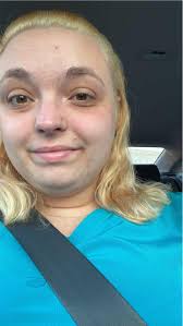 How to remove dark circles from photo?