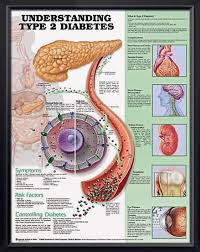 If left untreated, diabetes can cause many health complications. Diabetes Type Ii Symptoms Risk Factors And Hno At