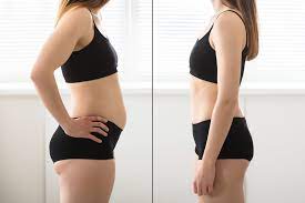 Die kosten der haarimplantation wird von den patienten sehr sehr ernst genommen, obwohl es genau so wichtig ist, wie alle anderen ästhetische operationen die am körper durchgeführt werden. Gymondo Vorher Nachher Erfolgsgeschichten Fitness Tiger