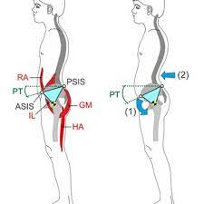 Voluntary Reduction Of Pelvic Tilt By A 16 Year Old Subject After The Download Scientific Diagram