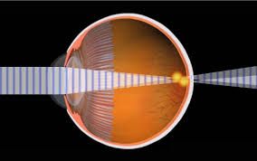Welcome to lifetime vision care. Eye Health