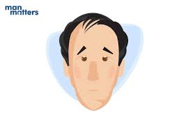 Over time, the hairline recedes to form a characteristic m shape. 7 Stages Of Male Pattern Baldness Male Balding Patterns 101