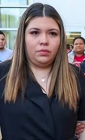 Does Elon Musk have a bruise