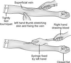 Image result for Venous Blood Sampling