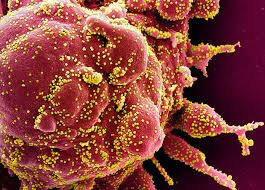 Он находится в подсемействе orthocoronavirinae семейства coronaviridae. 1lairm4bzfnc7m