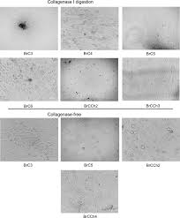Jul 08, 2021 · nrf2 suppresses prostate cancer cells viability, migration, and mitosis by upregulating ferroportin expression. Establishment Of Primary Human Breast Cancer Cell Lines Using Pulsed Hypoxia Method And Development Of Metastatic Tumor Model In Immunodeficient Mice Cancer Cell International Full Text
