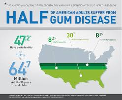 cdc half of american adults have periodontal disease