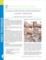Ponseti method on wn network delivers the latest videos and editable pages for news & events, including entertainment, music, sports, science and more, sign up and share your playlists. Pdf Percutaneous Needle Tenotomy For Tendo Achillis Release In Cases Of Clubfoot Technical Note