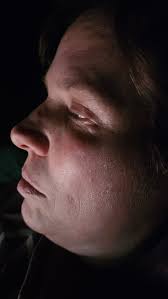 Why do my eyes hurt and feel like glass?