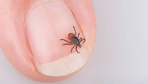 Image result for infected tick bite