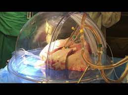 First, a doctor refers a patient to a regional transplant center. Lung Transplant I Ohio State Medical Center