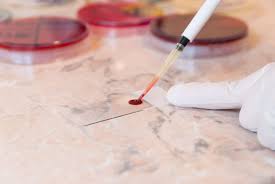 Image result for Peripheral Smear