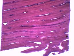 Any bone burned to a calcined state would not look like this. Bone Cross Section Longitudinal Section Prepared Microscope Slid Eisco Labs
