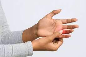 Video này sẽ giới thiệu những dấu hiệu cơ bản để giúp nhận. NÄƒm Triá»‡u Chá»©ng Báº¥t ThÆ°á»ng Cá»§a Bá»‡nh Nhan Covid 19 Vietnamnet