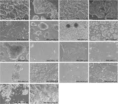 A light purple or lavender ribbon is generally used to represent all cancers as a whole. Establishment And Characterization Of 18 Human Colorectal Cancer Cell Lines Scientific Reports