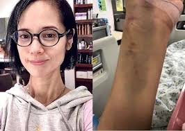 Ngôi sao phim 18+ Trịnh Diễm Lệ bệnh nặng