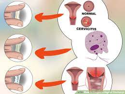 The important thing is to be aware of the signs of cervical cancer most women have fairly regular cycles. 10 Warning Signs Of Cervical Cancer You Shouldn T Be Ignoring Magazine Life Style