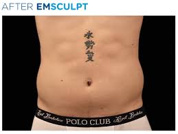 Green ink is the most resistant to laser treatment. Tattoo Removal Berkshire
