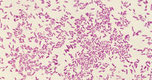 Image result for Schoenoplectiella microglumis