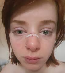 Student who broke woman's nose is ordered to write apology letter as  punishment