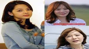 Deretan Artis Korea Gagal Operasi Plastik Wajah Barbie Berubah Jadi Plastic Monster Tribun Pontianak
