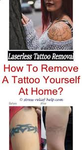 Tattoos used to be considered permanent, but thanks to advances in laser technology, today's lasers can get rid of tattoos more safely and effectively, including removing tattoo ink with fewer treatments and treating ink colors that were once difficult to remove. Pin On Tattoo