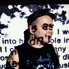 Blog — vitreous chamber