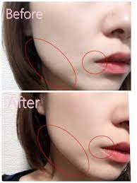 プチプラのセラミド配合の化粧品でもお肌が保湿されるか 実際に試してみました 美容液と乳液を購入して使ってみた結果 うれしい変化が 保湿にセラミドは欠かせませんね 美容 セラミド 顔 保湿