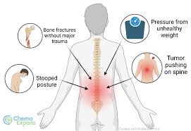 Image result for Cancer Pain