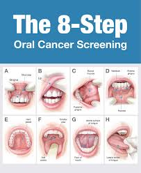 Just like with any forms of cancer, distant metastasis provides the most unfavorable picture for patients. Oral Cancer Diagnosis Oral Cancer Treatment In India Hcg Oncology