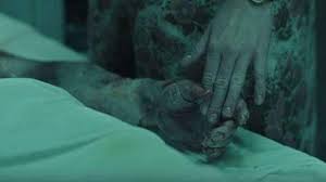 The accident at a nuclear power plant in ukraine shocked the world, permanently altered a region, and leaves many questions unanswered. Chernobyl How The Radiation Burns Were Created By Make Up Prosthetics India Forums