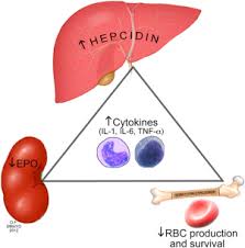 Anemia Of Chronic Disease Sciencedirect