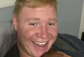 Dude shave your bald head