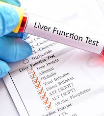 Image result for Liver Function Test