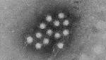  Hepatitis vaccines urged for travelers to Kentucky, Michigan