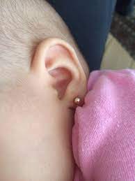 Babypiecing Information Regarding Piercing Infants Thru Adults No Body Piercing Baby Ear Piercing Infant Ear Piercing Ear Piercing Babies Ear Piercing For Infants Toddler Ear Piecing Children