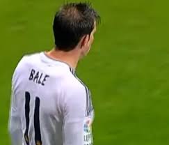 Anche da qui si vede bene quella riga dietro. Gareth Bale E Lo Chiffon Riporto La Calvizie Avanza