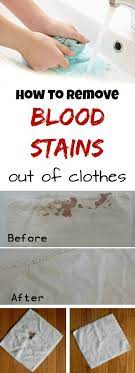 If the stain is super fresh, place it under cold running water to flush out as much of the blood as possible. Remove Old Blood Stains