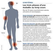 La quinine du ghana : Maladie De Lyme Quand Les Tiques Attaquent Sciences Et Avenir