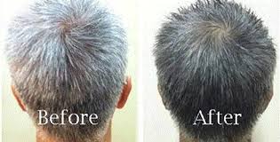 Helps fight off harmful bacteria. How Mustard Oil Help For Grey Hair To Turn Black Mustard Oil For Hair Reverse Gray Hair Grey Hair Remedies