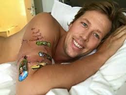 /r/freekvonkmemes metrics (freek vonk memes). This Guy Is A Legend Freek Vonk Bitten By A Shark Has His Own Plasters On His Wound 9gag