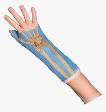 Polaland waterproof arm cast wound cover for shower bath, watertight casts and bandages protector sleeve bag for injury recovery, broken bones hands. Bones Wrist Bones Casttoo Orthopedic Cast Tattoos Gif Orthopedic Cast Hd Png Download Kindpng