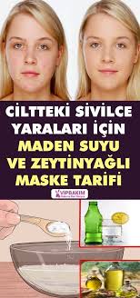Ciltteki Sivilce Yaralari Icin Maden Suyu Ve Zeytinyagli Maske Tarifi Vipbakim Maskeler Dogal Cilt Bakimi Dogal Guzellik Ipuclari
