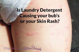 If Laundry Detergent Or Fabric Softener Is Causing Skin Irritation Use Dye Free Fragrance Free Deterge Laundry Detergent Fragrance Free Products Detergent