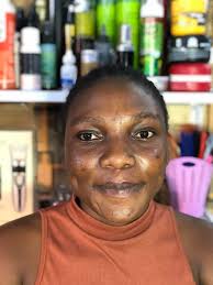 paedit before & after template