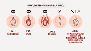 Kalau plan sunat bayi di klinik, dapatkan nasihat doktor terlebih dahulu dan ikut prosedur seterusnya. Khitan Selamat Atau Tidak Semasa Mstar